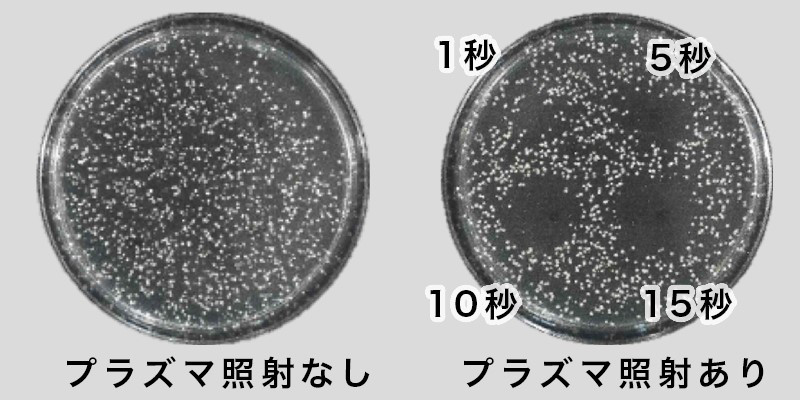 プラズマシャワー&ソノポレーション | 一般社団法人 美療矯正協会